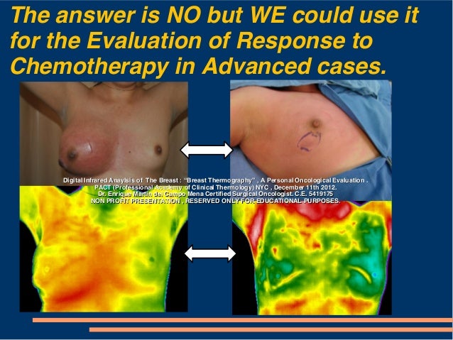 nyc breast thermal imaging Nyc breast thermal imaging